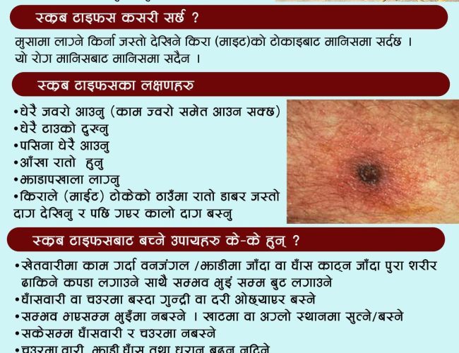 स्क्रब टाइफसबारे गलकोट नगरपालिकाको विशेष अनुरोध